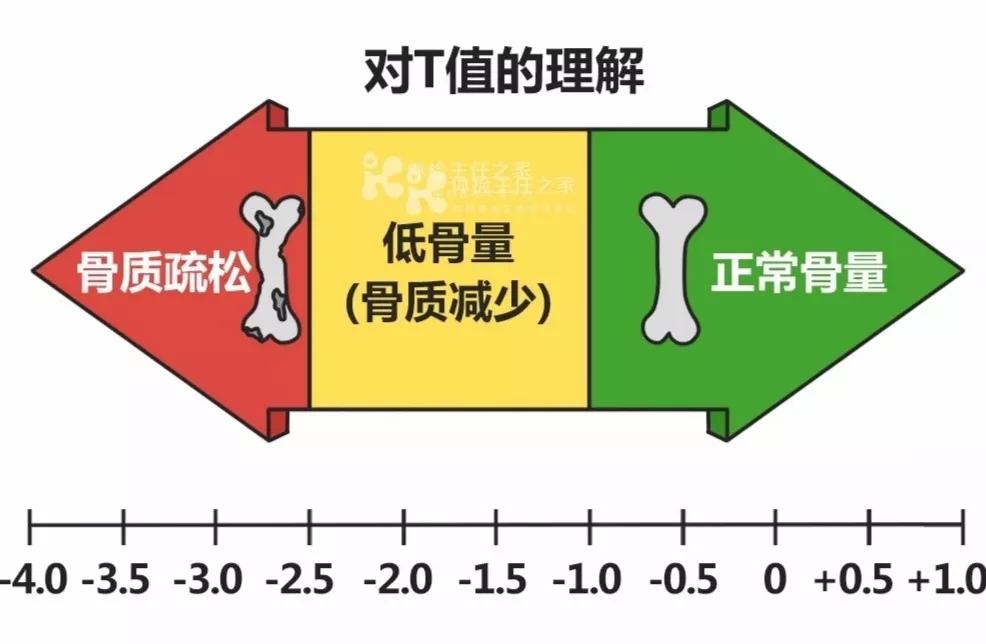 骨密度图片怎么看图片