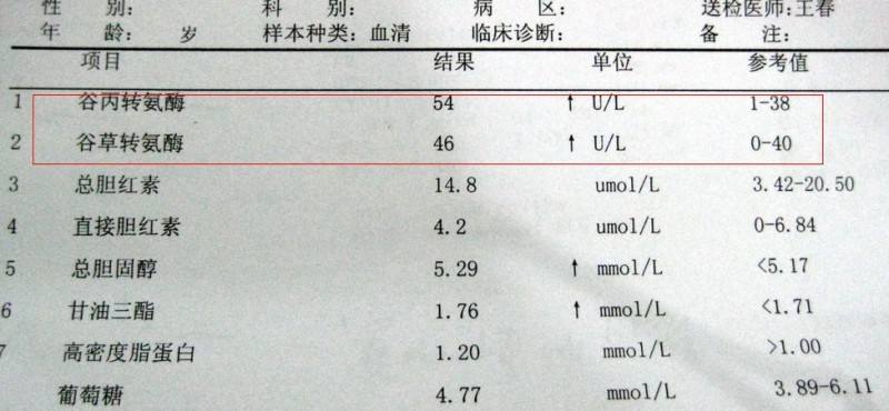 1, 肝炎的症状,体内转氨酶含量高时,有可能是发生了肝炎疾病,肝炎的
