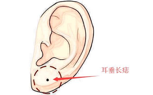 石崇巨富痣区域范围图片