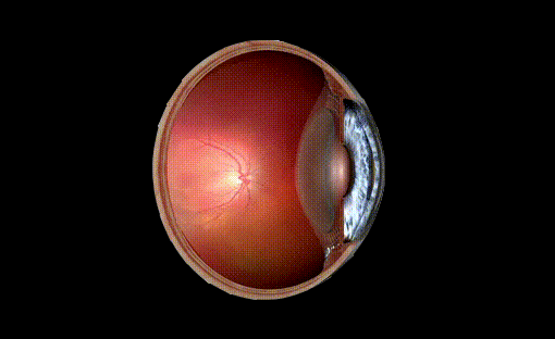 在视网膜汇聚成像光线无遮无拦地穿过没变性的玻璃体清澈透明99%是水