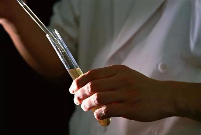 体检最常见的尿检非常重要它的重要性你要知道