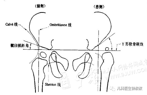 鸭子步图解图片