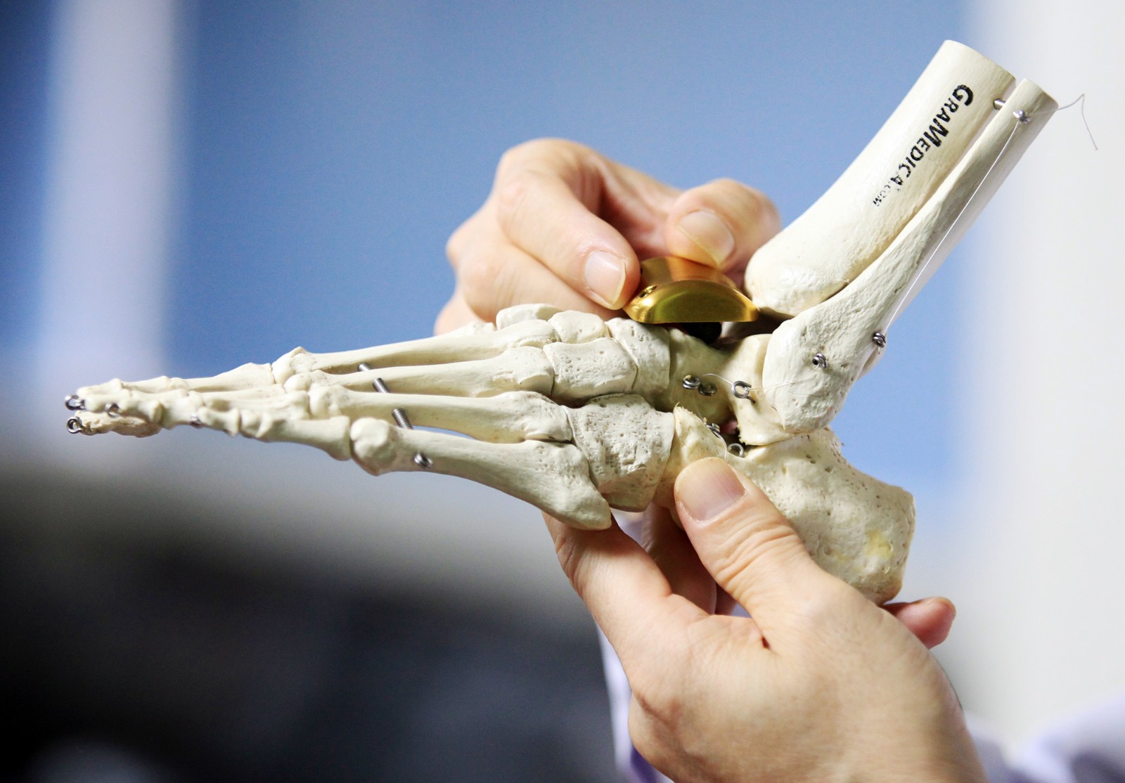 45岁的韩女士3年来反复出现踝关节疼痛,随着活动增加,疼痛加重,日常