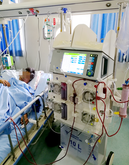 保山昌宁县人民医院icu开展床旁crrt治疗 成功挽救危重患者