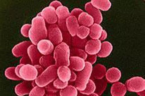 布氏杆菌病的危害太大了养牛人注意