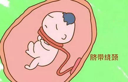 惊险调皮宝宝脐带打结险些酿成大祸