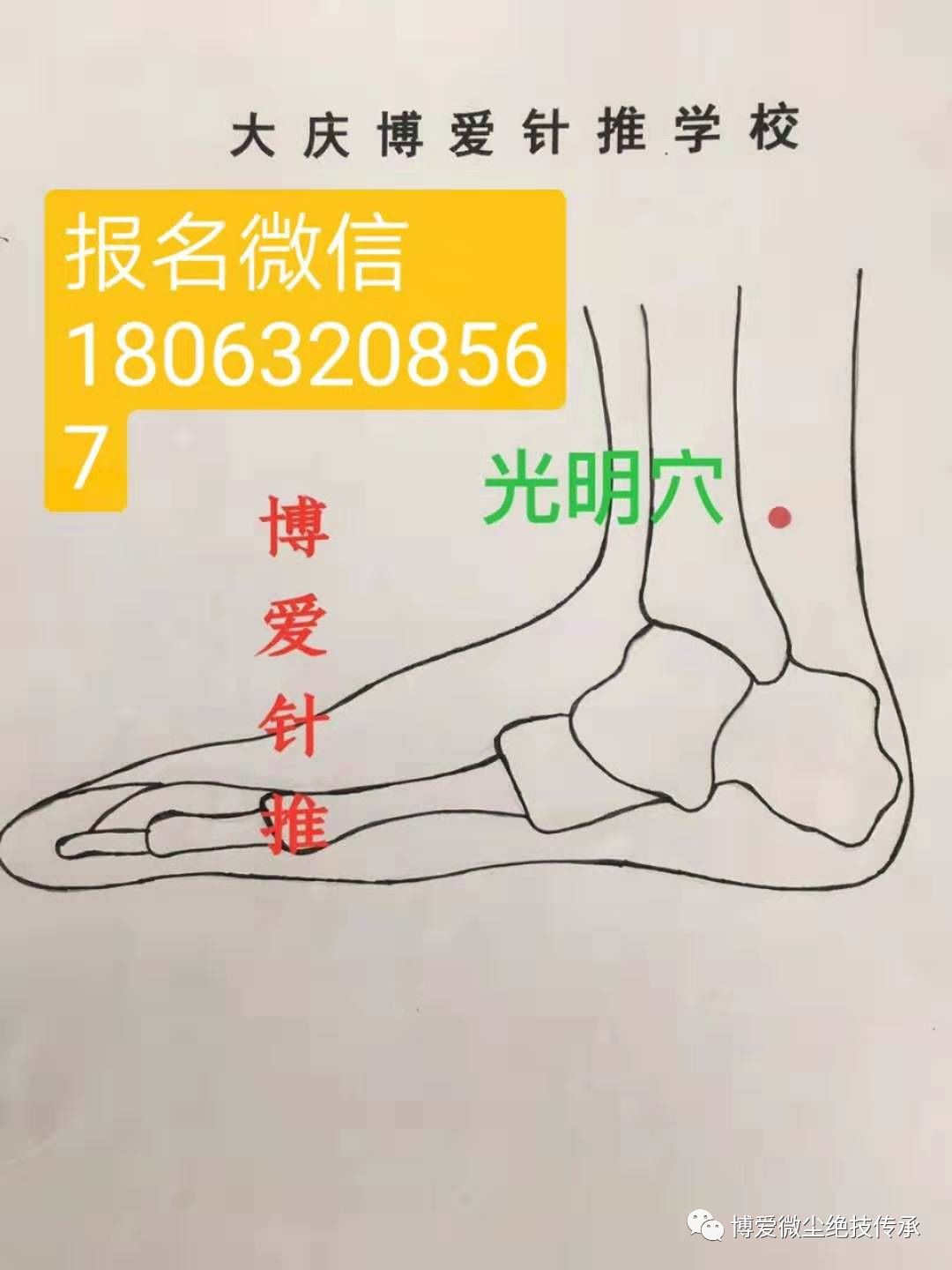 董氏奇穴光明穴三重穴