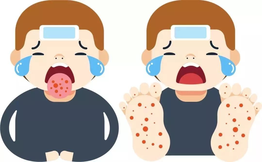 手足口那些事六句秘笈孩子少受罪