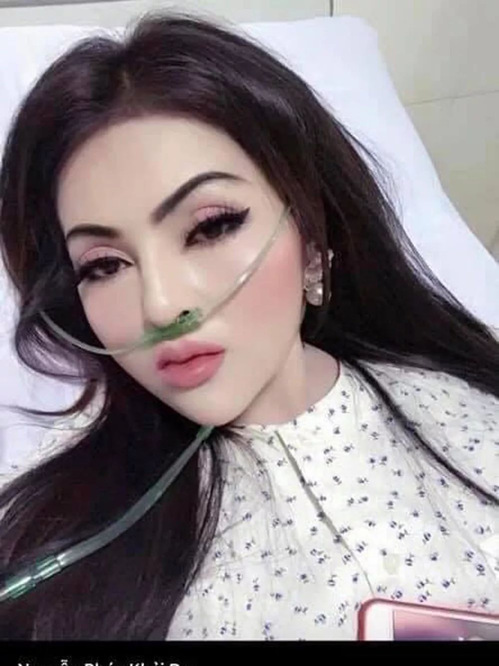 越南网红住院浓妆艳抹爱尔兰仙女整整五年睡觉不卸妆素颜像裸奔