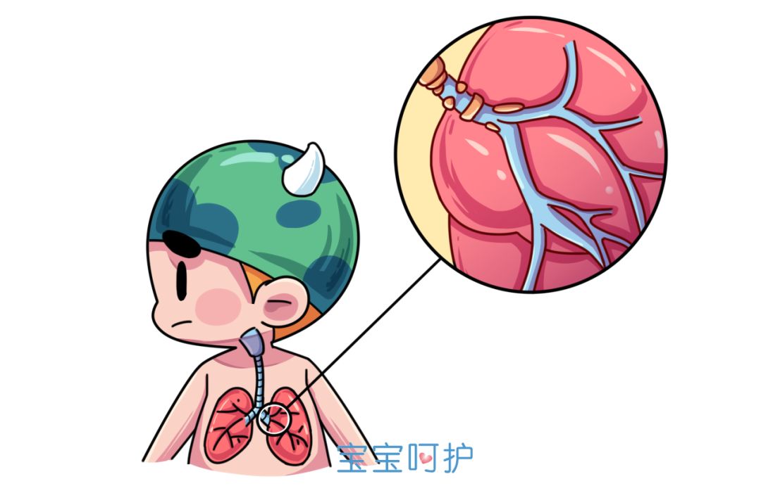 "一不小心被感染,不能正常工作,人表现出气促,喘息和胸壁吸气性凹陷等