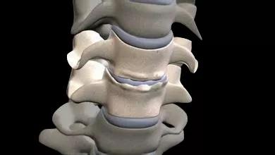 颈子僵肩膀痛8个动作拯救僵硬脖