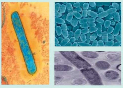 枯草芽孢桿菌微觀下的照片_電鏡