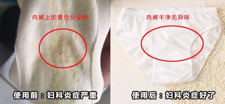 便秘,赘肉,风湿全好了!