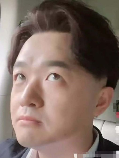 有种逆袭叫包贝尔有头发,看到他植发后的颜值,终于相信包文婧的