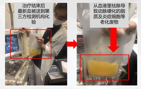 血液淨化療法