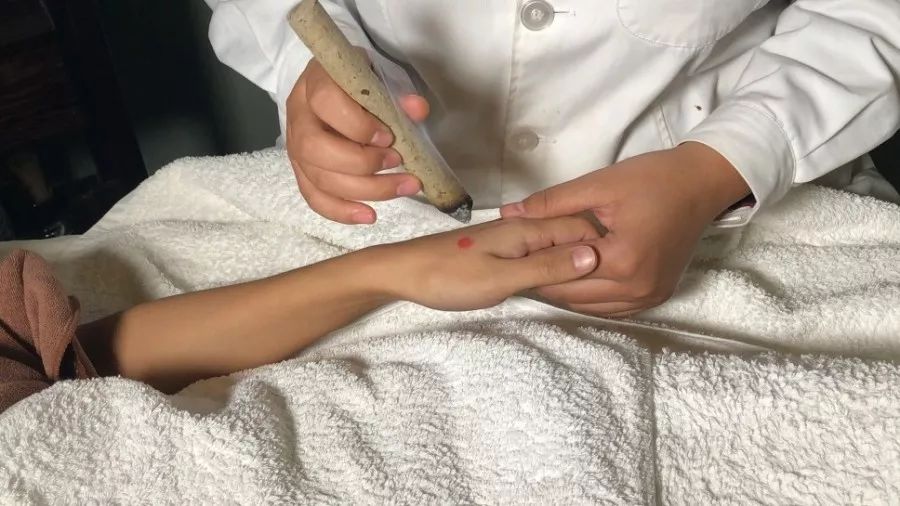 感冒的艾灸疗法,限时免费