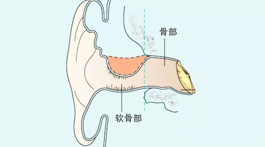 耳软骨结构图图片