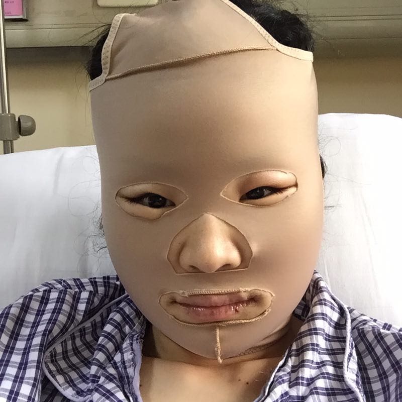 卢丙仑教授:面部轮廓整形的方法及其潜在风险