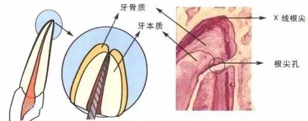 氧化锌丁香油糊剂图片