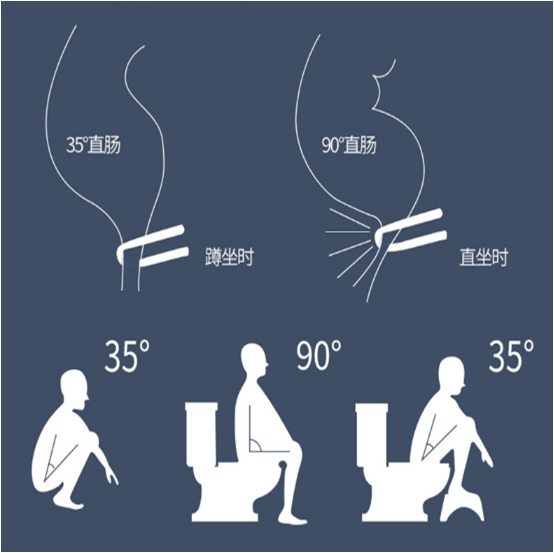 而马桶出现只是近30年的事,且坐姿排便时,双腿与躯干成90度角时,经
