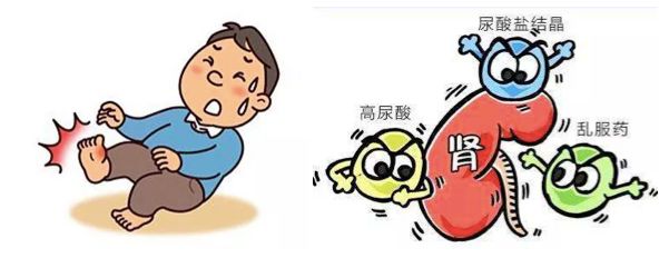 尿酸高怎么破除了痛风可危害多多不可不说的第四高