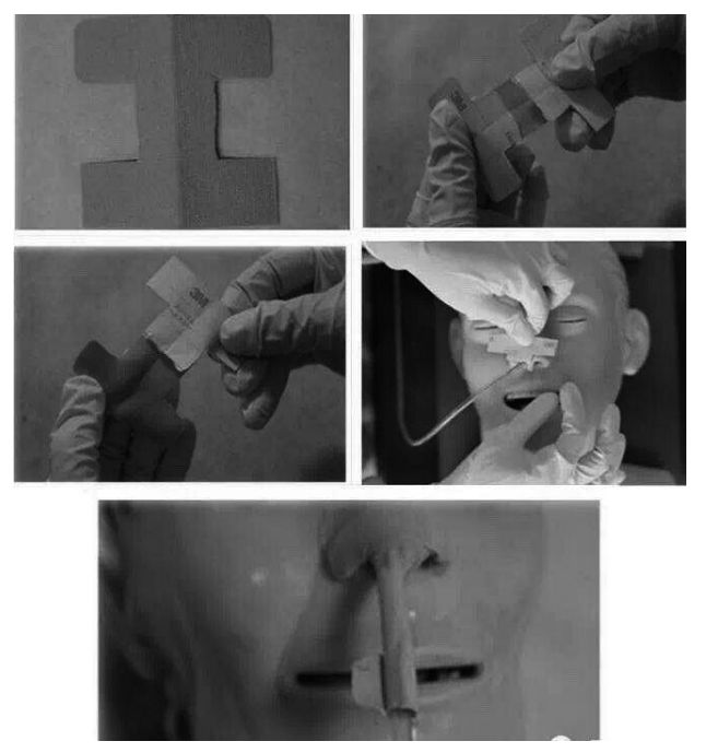 自插胃管的那些事