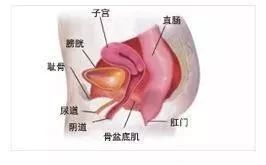 具體表現為:子宮脫垂,膀胱膨出,尿道膨出,小腸膨出,大腸膨出,陰道脫垂