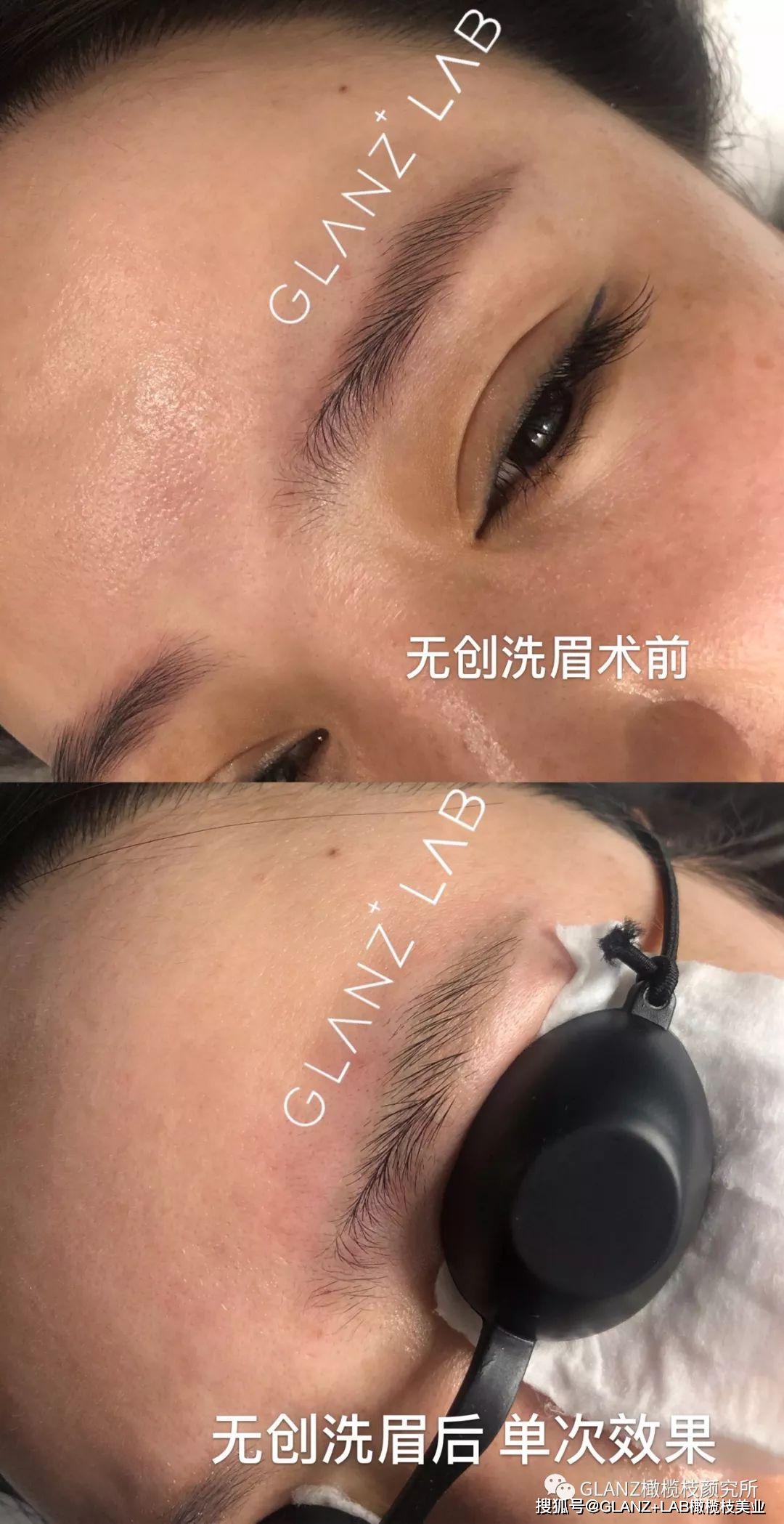 橄榄枝美肌颜究所黑科技无创洗眉把你变成时尚新美眉