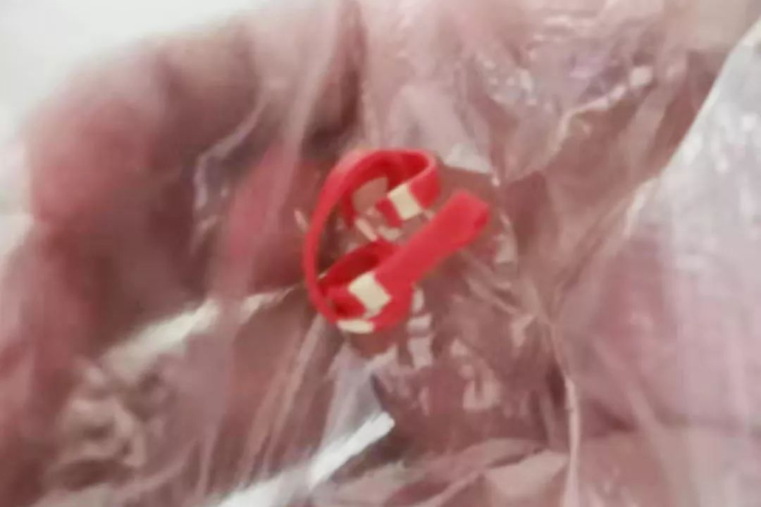 量多,浸湿被褥20*20厘米范围,颜色鲜艳,追问病史,近一周流黄色分泌物