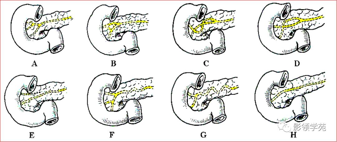 胰腺的解剖与常见变异