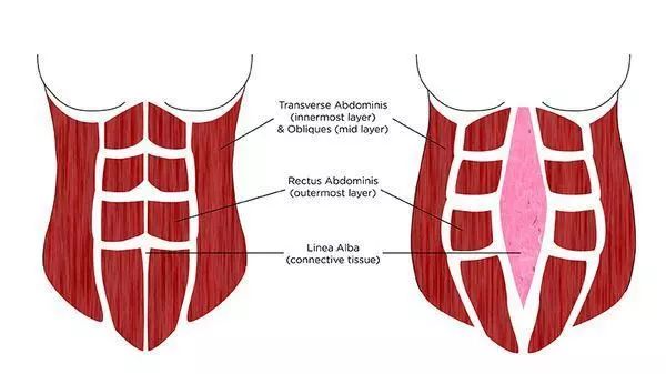 腹直肌鞘绘图图片