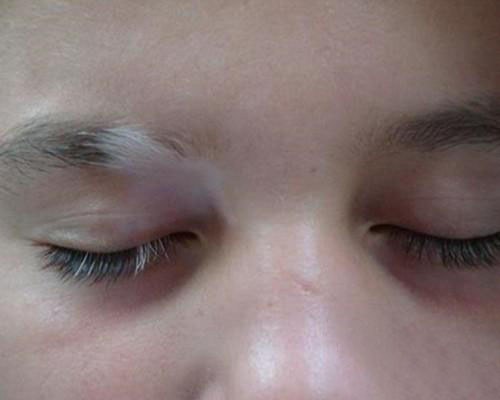 光看眉毛就知道了的疾病?这可太神奇了!从此再也不敢拔眉毛了!