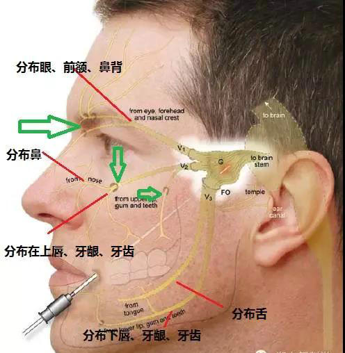 体表神经解剖:三叉神经详解