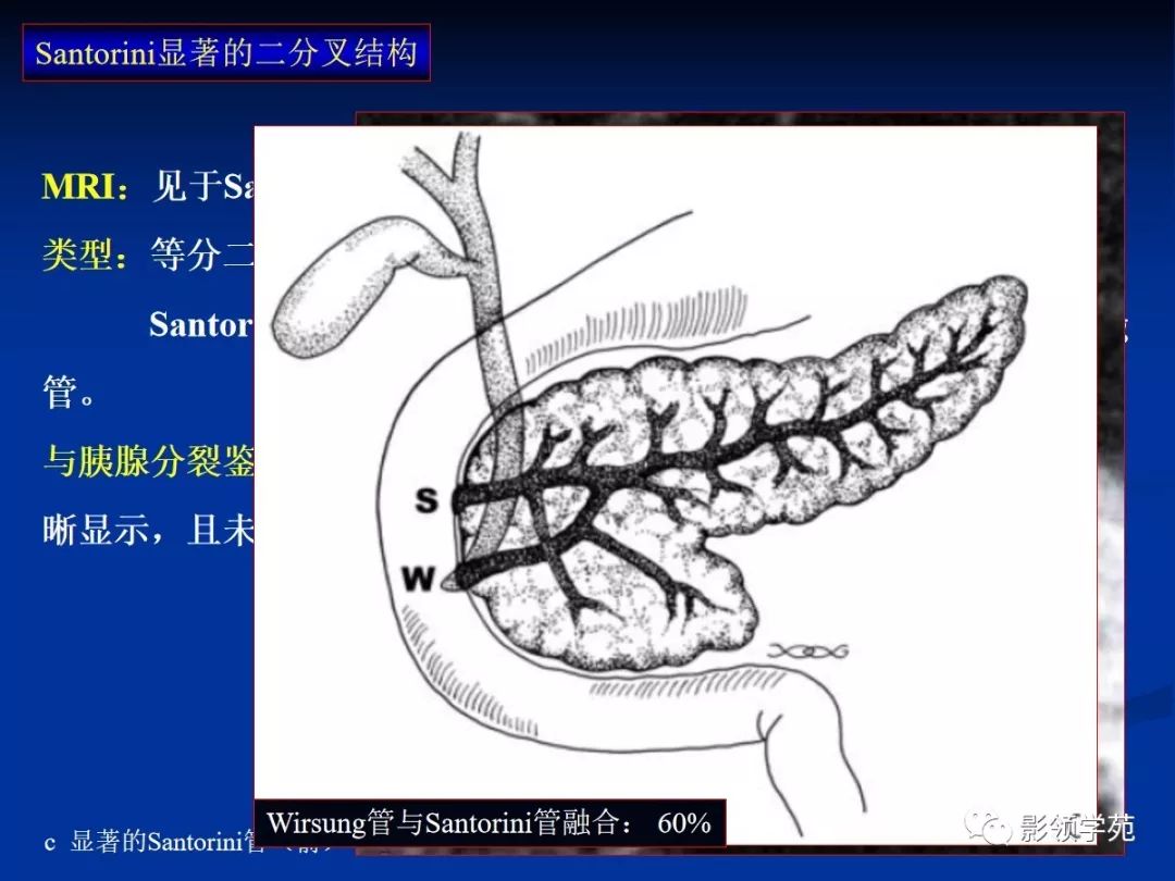 胰腺的解剖与常见变异