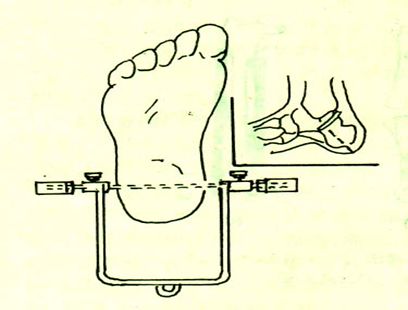 骨科牵引术的护理全是干货一定要收藏