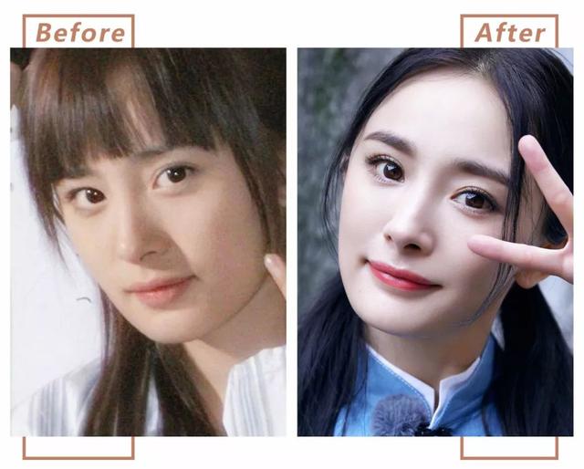 沈梦辰的眼睛变大了开眼角真的有那么神奇吗