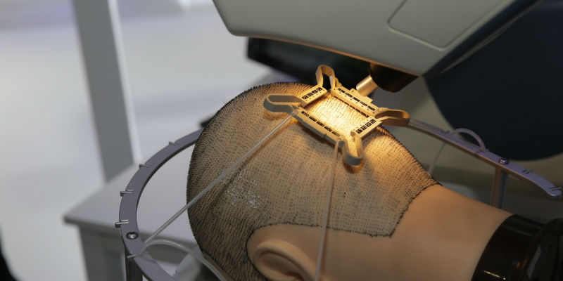 直击进博会医药馆前沿成果盘点植发手术机器人带状疱疹疫苗细胞和基因