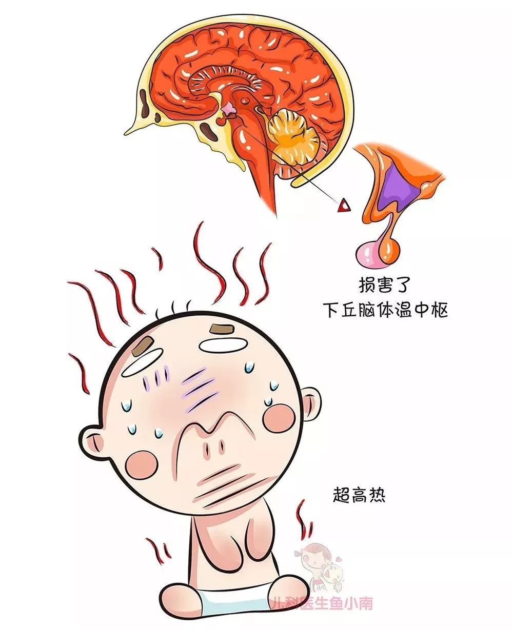 散热障碍也是发热的原因之一,像广泛性皮炎,大面积烧伤,先天性汗腺