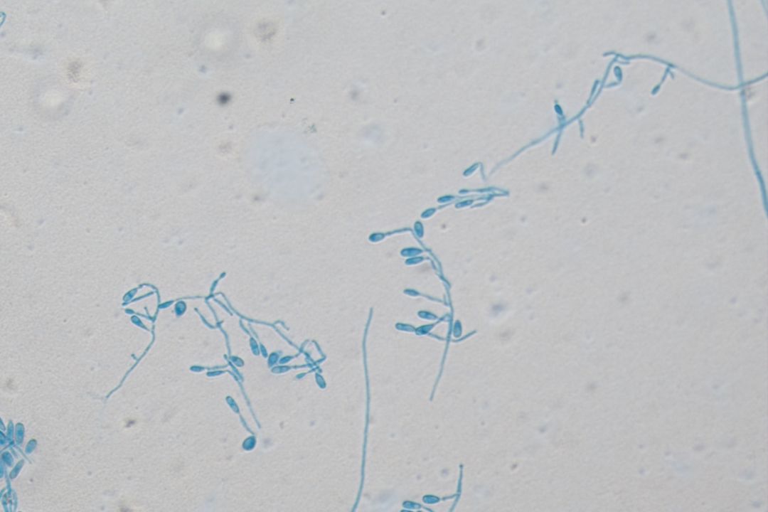 今天我们聊聊真菌那些事