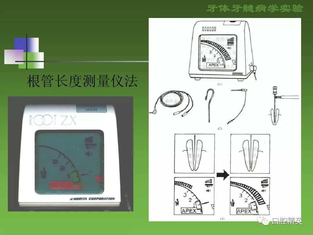 rct根管治疗
