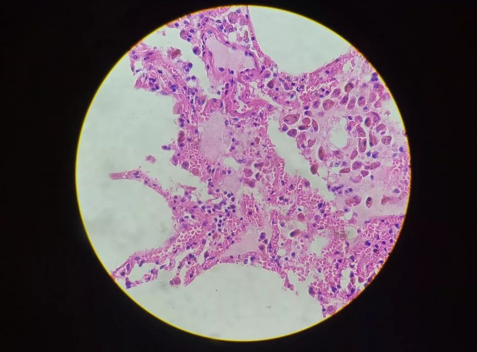 肺泡镜下图片