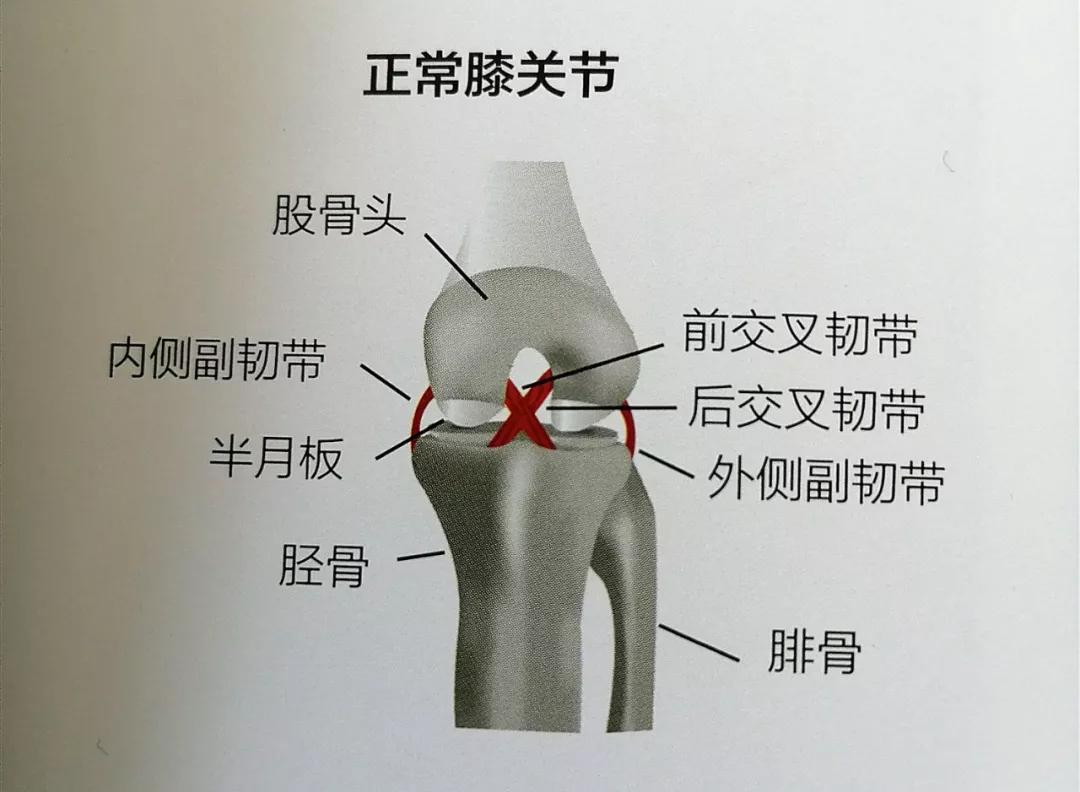 膝關節不穩總受傷這些部位的訓練對膝關節穩定更有效