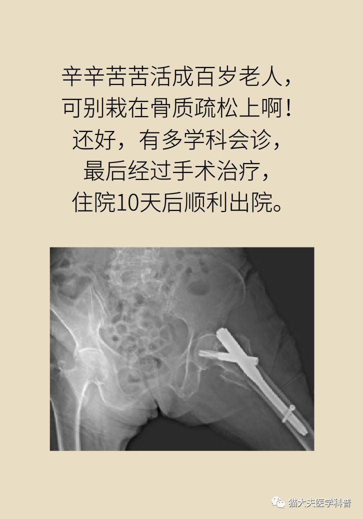 打个喷嚏老腰断了什么病这么要命