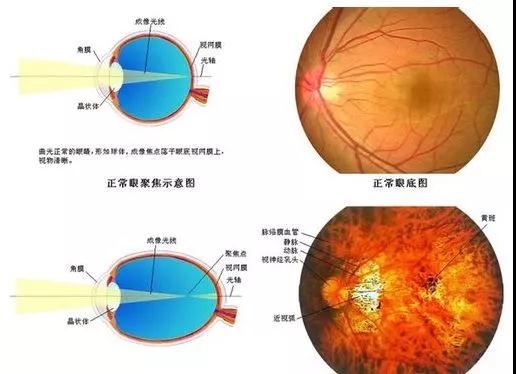 在眼球增大的过程中,巩膜和脉络膜都可以按照眼内部的信号要求而不断
