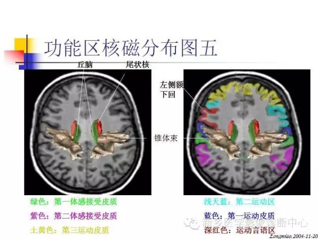 脑磁共振局部解剖功能图解
