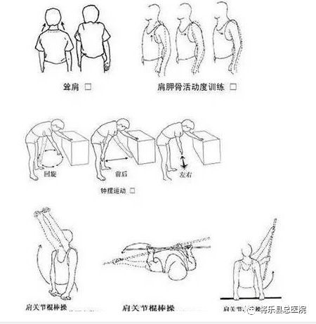 科普 肩袖损伤怎么处理?听康复医学科的专业建议