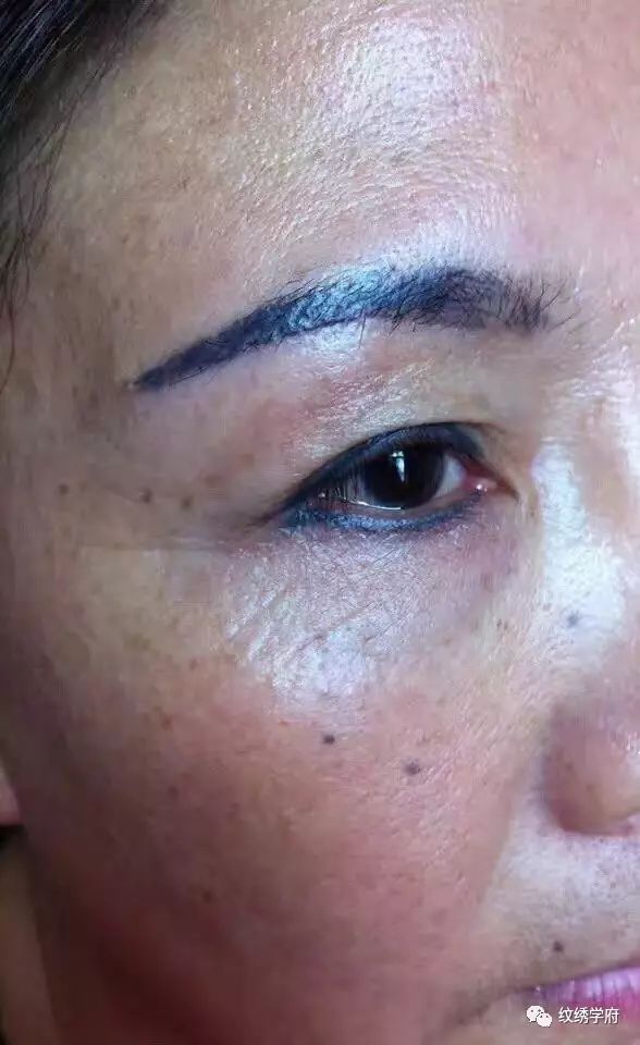 美瞳线的色料要求最高 不纯正的色料 肯定容易变色 晕色 导致发炎