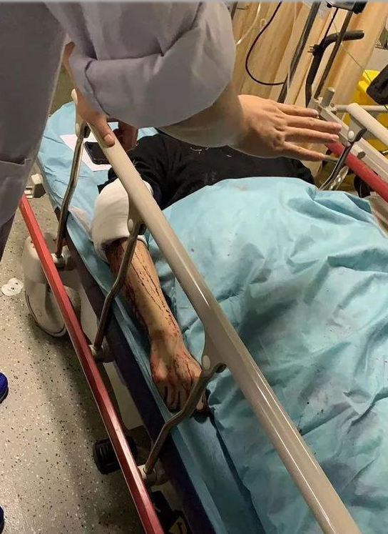 滴滴又出事五星司机持刀捅伤乘客口出狂言我舅舅是公安局长