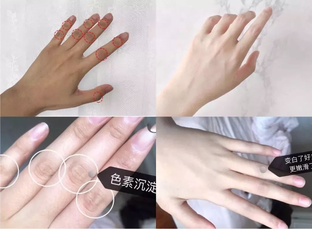 日本变态手霜效果堪比换皮轻轻一抹双手一夜重回婴儿肌