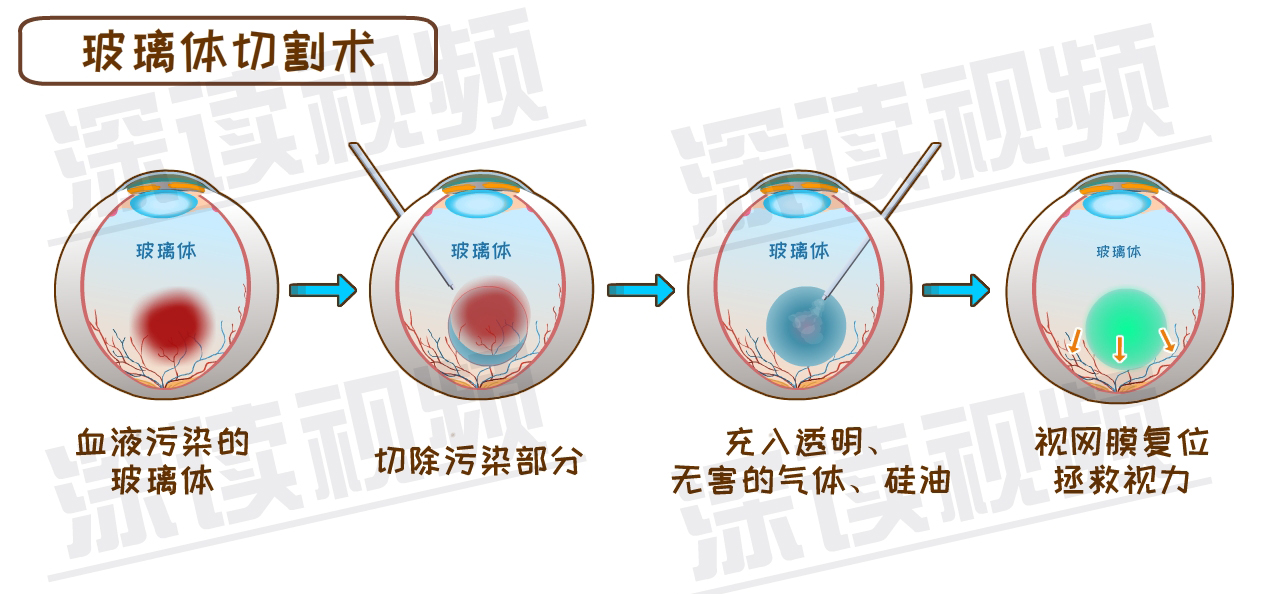 巩膜怎么读图片